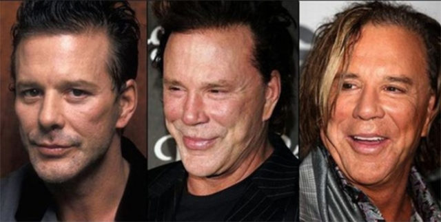 Hollywood Celebrities Who Have Spent Thousands On Cosmetic Surgery Page Of True