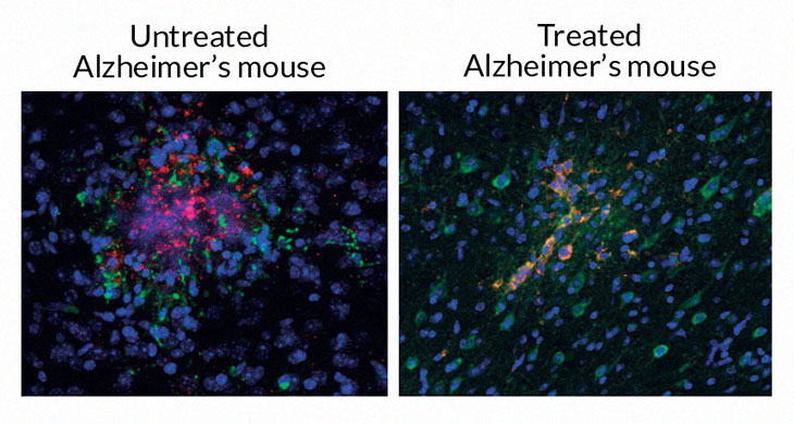 Alzheimer’s In Mice Reversed Using Light and Sound Only.. could be Simple At-Home 1 hr a day Cure Alzheimers-mouse2